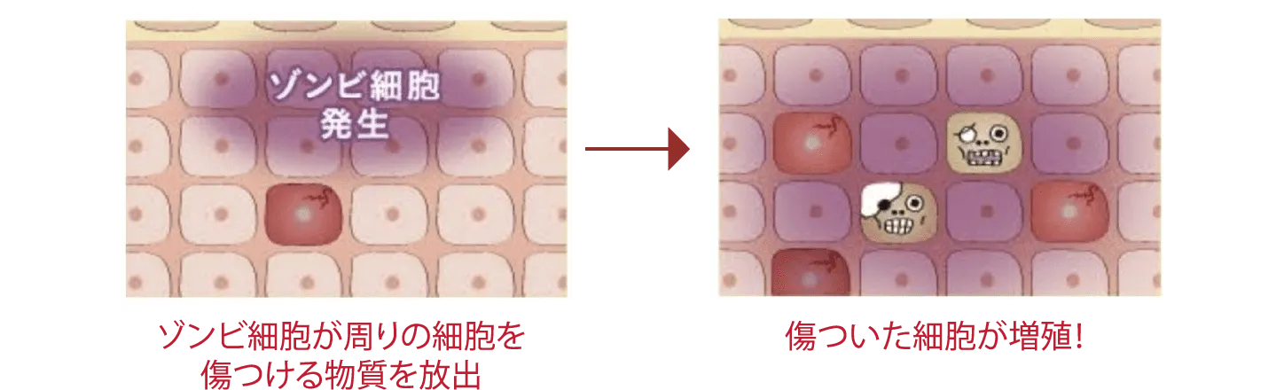 ゾンビ細胞の振る舞い